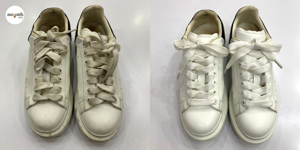 Các bước sửa giày tại Quận 9